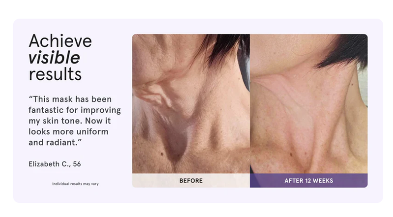 PIGMENTATION
